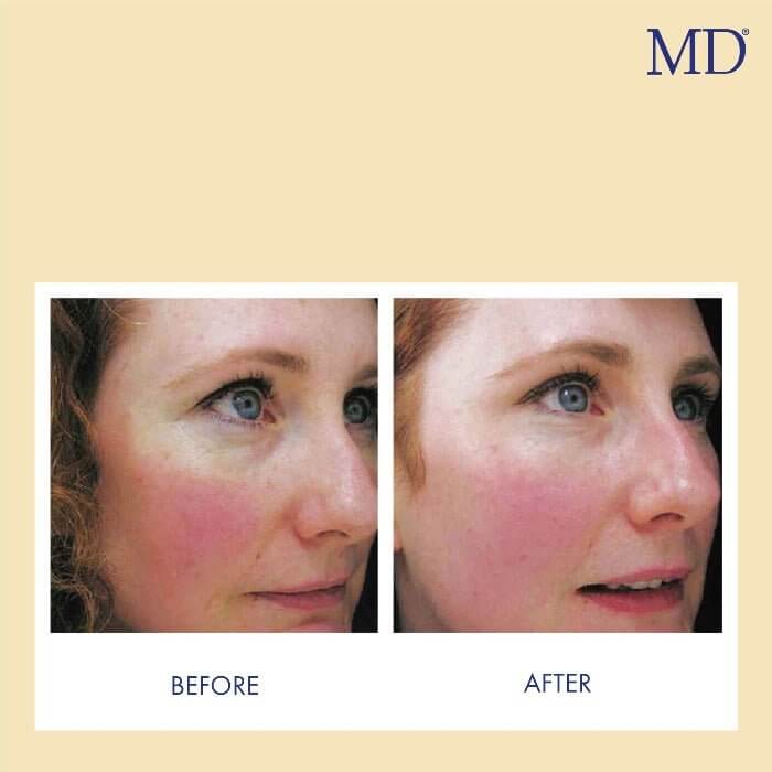 MD Factor Vitamin C Face Serum - Anti-Aging Face Serum with Vitamin C - 1 fl oz e/ 30ml - MD