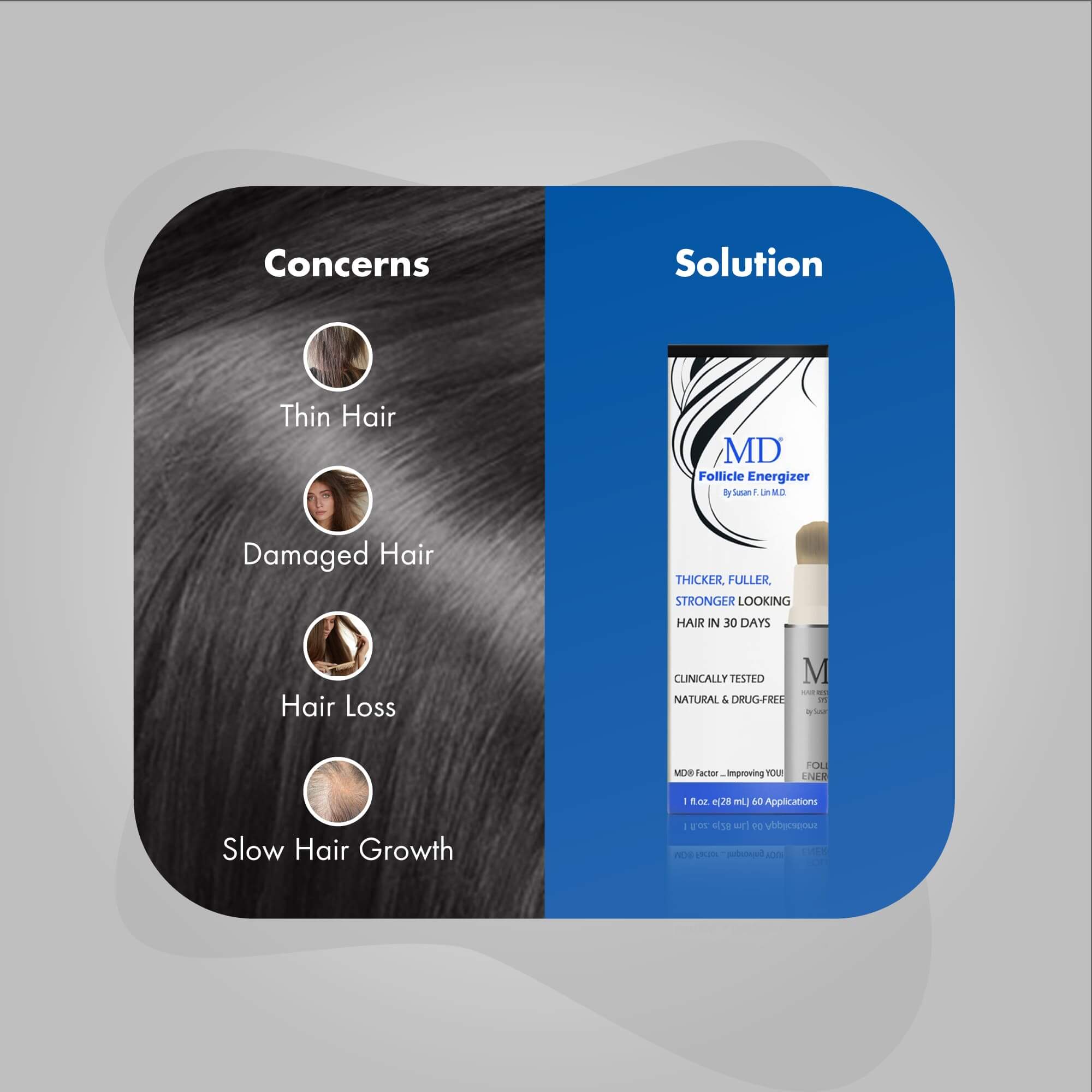 Photo showing common hair concerns including thinning hair, hair loss, receding hairline, and slow growth with MD Hair system products as the solution – featuring MD Nutri Hair and MD Follicle Energizer for drug-free hair regrowth and follicle support"