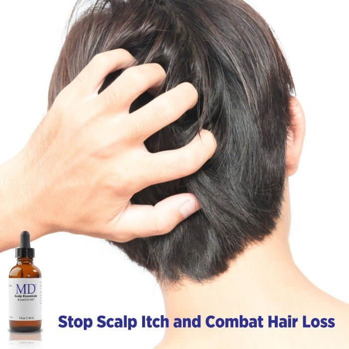 MD Scalp Essentials next to person scratching scalp – helps stop scalp itch and supports hair loss prevention with soothing, oil-balancing formula
