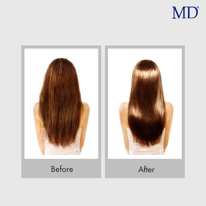 Before and after using MD Nourishing Shampoo and Conditioner from MD Hair—after photo shows visibly shinier, softer, and healthier hair