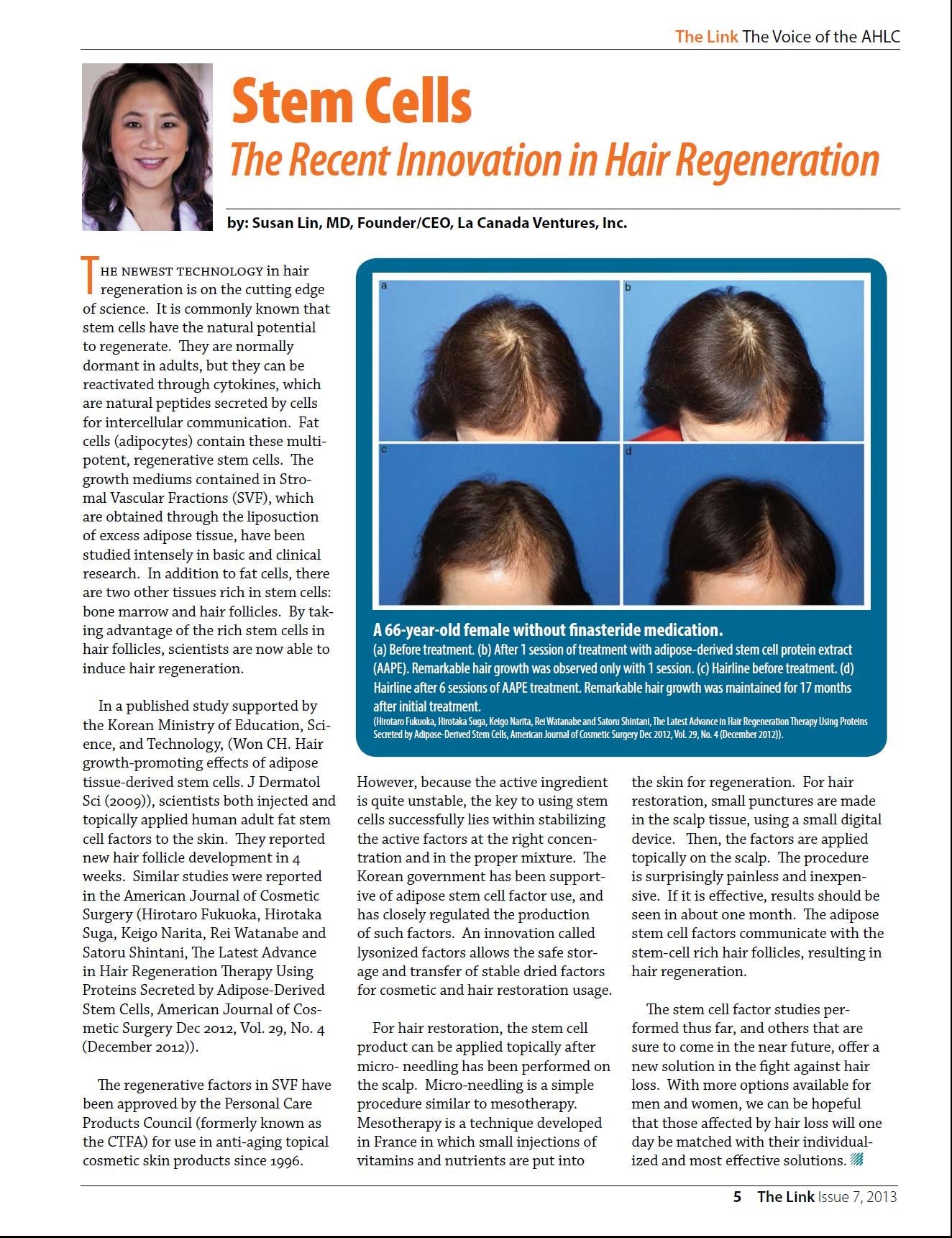 Scalp Aging — The Science Behind Declining Density and How to Reverse It