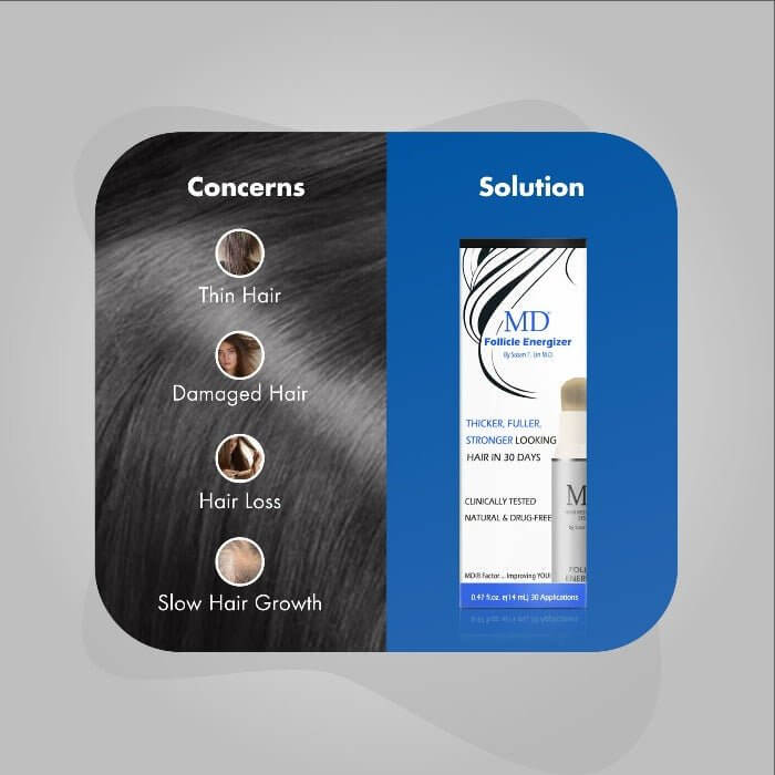 MD® Follicle Energizer Serum - Natural Hair Growth Serum - 30-Day Supply - MD